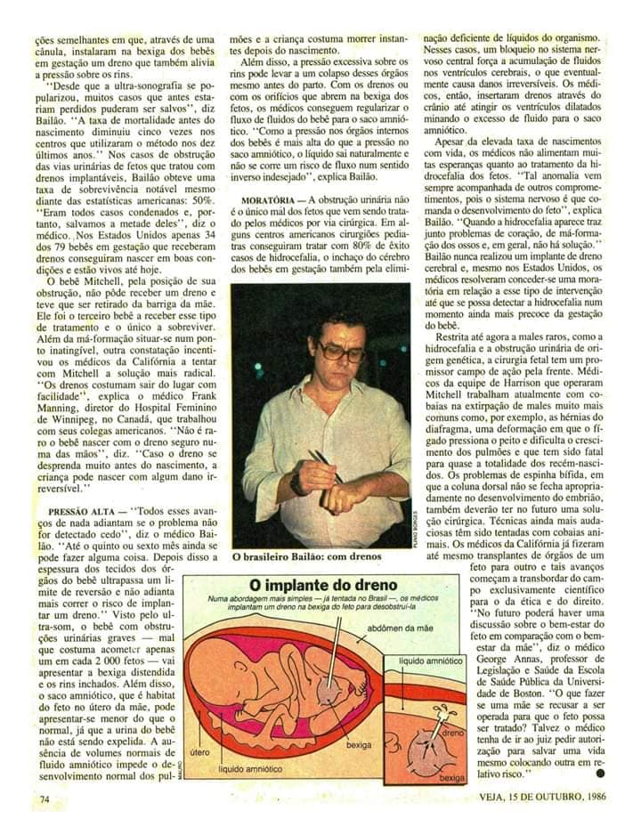 Prof. BailÃ£o em Reportagem a Revista Veja 15/10/1986