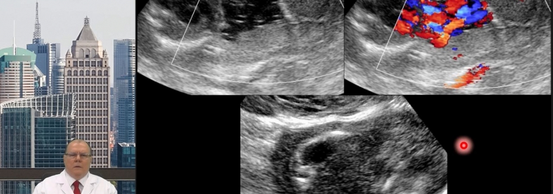 VÃ­deo Blog - Ultrassonografia do Ãmnio e da Cavidade AmniÃ³tica 