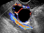 Ultrassonografia do FolÃ­culo Ovariano