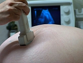Combo: Abortamento, Gravidez EctÃ³pica e DoenÃ§a TrofoblÃ¡stica Gestacional
